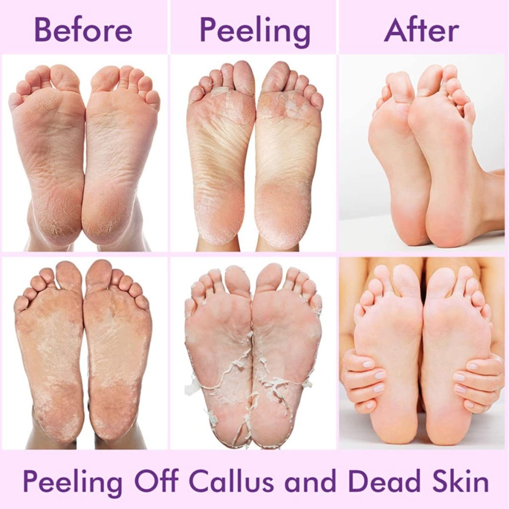 Foot Peeling Mask